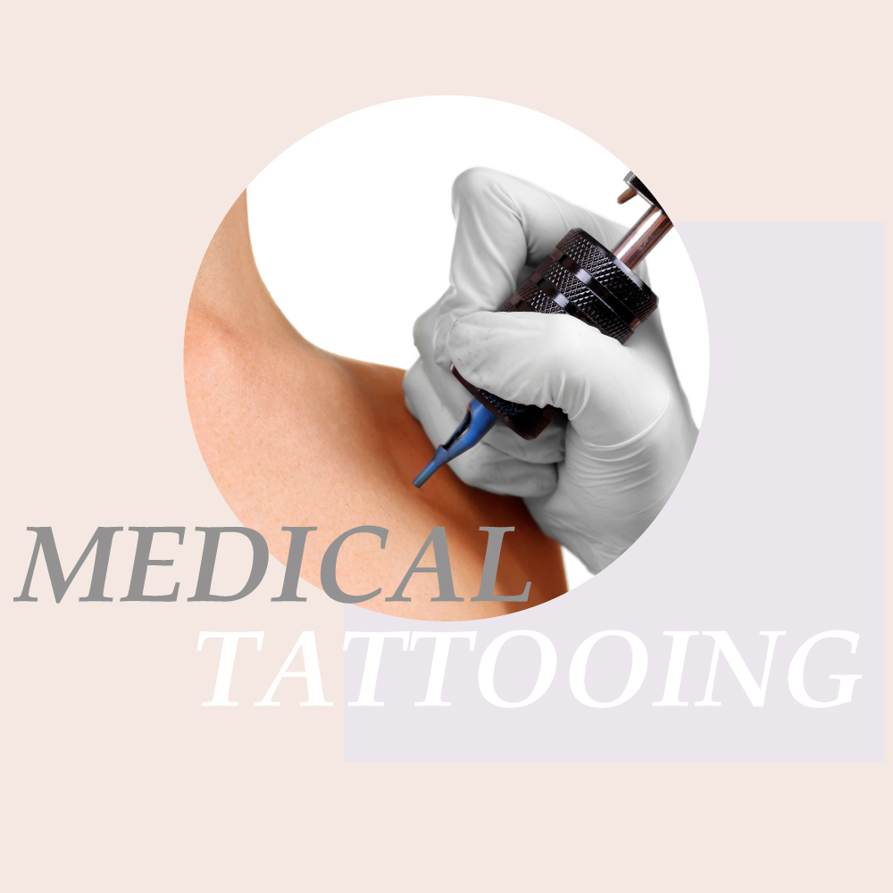 MEDICAL TATTOOING