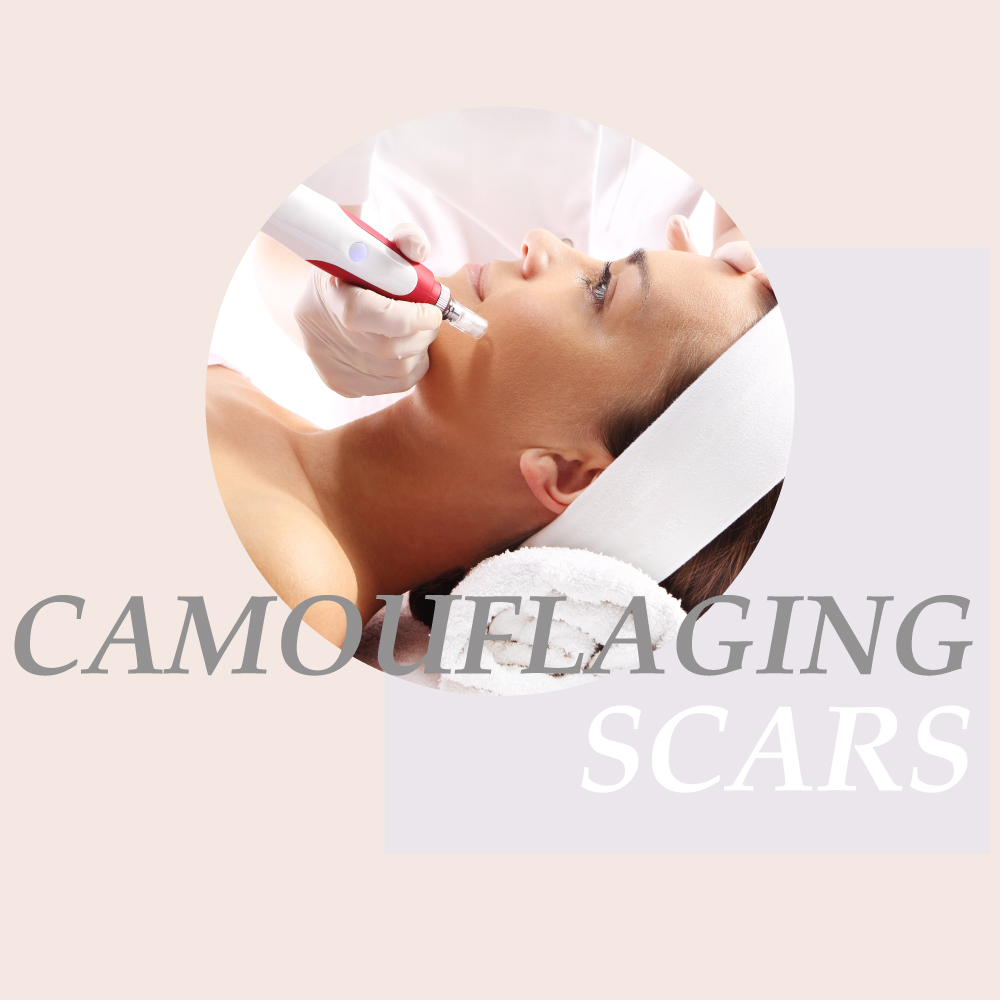 camouflaging scars