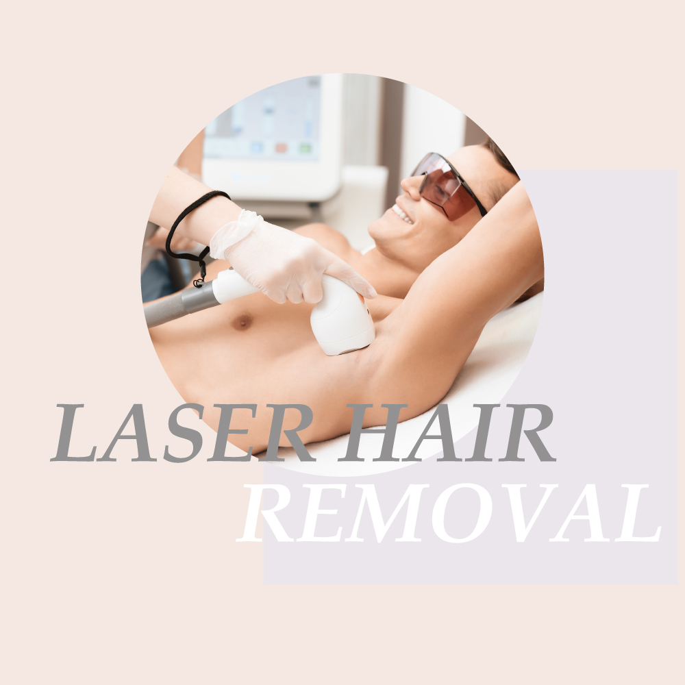 laser hair removal